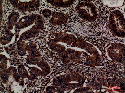Fig.4. Immunohistochemical analysis of paraffin-embedded human-colon, antibody was diluted at 1:100.
