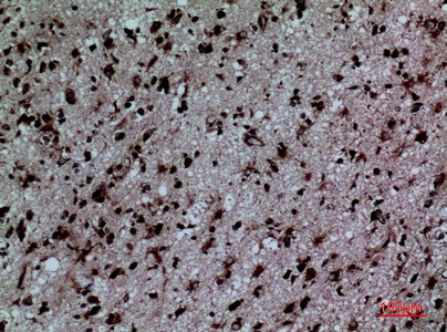 Fig.5. Immunohistochemical analysis of paraffin-embedded human-brain, antibody was diluted at 1:100.