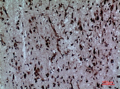 Fig.6. Immunohistochemical analysis of paraffin-embedded human-brain, antibody was diluted at 1:100.