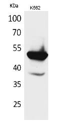 Fig.1. Western Blot analysis of K562 cells using Protein C Polyclonal Antibody. Secondary antibody (catalog#: A21020) was diluted at 1:20000.