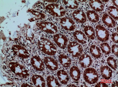 Fig.2. Immunohistochemical analysis of paraffin-embedded human-colon, antibody was diluted at 1:100.
