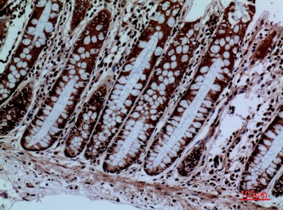 Fig.3. Immunohistochemical analysis of paraffin-embedded human-colon, antibody was diluted at 1:100.
