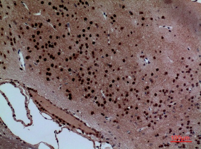 Fig.2. Immunohistochemical analysis of paraffin-embedded rat-brain, antibody was diluted at 1:100.
