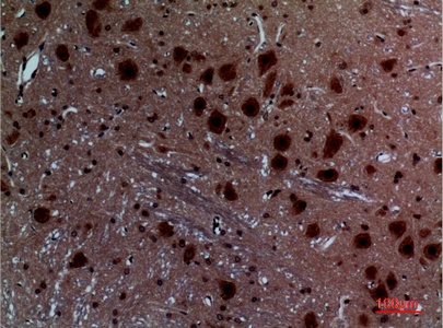 Fig.3. Immunohistochemical analysis of paraffin-embedded rat-brain, antibody was diluted at 1:100.