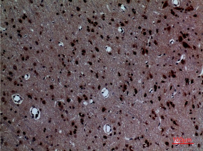 Fig.4. Immunohistochemical analysis of paraffin-embedded rat-brain, antibody was diluted at 1:100.