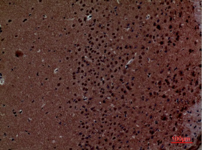 Fig.5. Immunohistochemical analysis of paraffin-embedded Mouse-brain, antibody was diluted at 1:100.