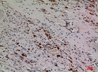 Fig.2. Immunohistochemical analysis of paraffin-embedded human-brain, antibody was diluted at 1:100.