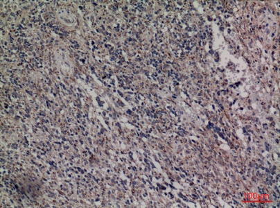 Fig.3. Immunohistochemical analysis of paraffin-embedded human-brain, antibody was diluted at 1:100.