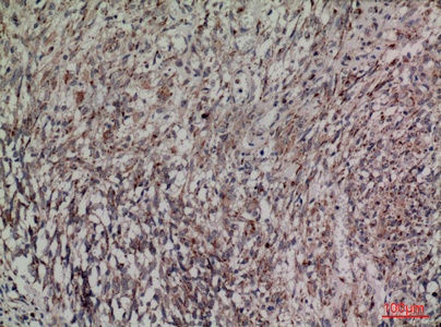 Fig.4. Immunohistochemical analysis of paraffin-embedded human-brain, antibody was diluted at 1:100.