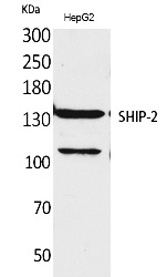 Fig.1. Western Blot analysis of HepG2 cells using SHIP-2 Polyclonal Antibody. Secondary antibody (catalog#: A21020) was diluted at 1:20000.