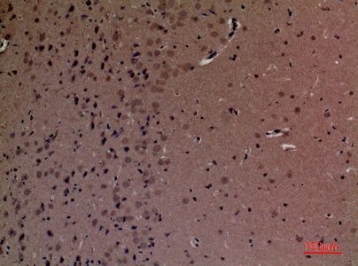Fig.2. Immunohistochemical analysis of paraffin-embedded Mouse-brain, antibody was diluted at 1:100.