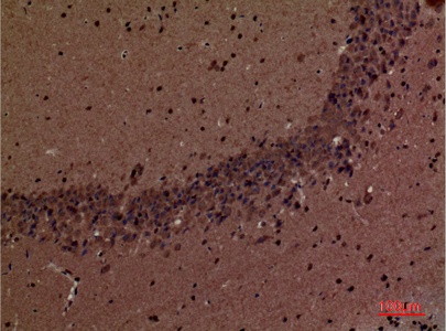 Fig.3. Immunohistochemical analysis of paraffin-embedded Mouse-brain, antibody was diluted at 1:100.