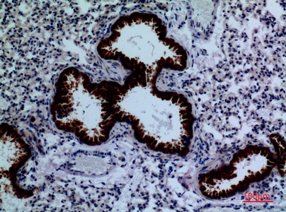 Fig.2. Immunohistochemical analysis of paraffin-embedded Mouse-lung, antibody was diluted at 1:100.