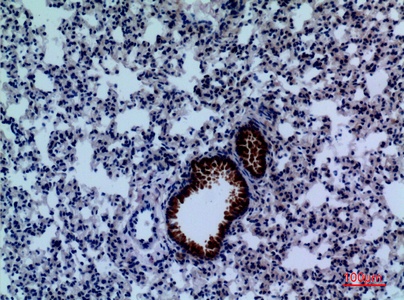 Fig.4. Immunohistochemical analysis of paraffin-embedded Mouse-lung, antibody was diluted at 1:100.