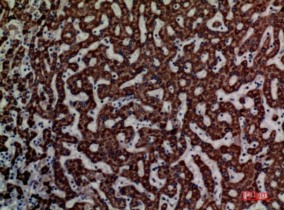 Fig.2. Immunohistochemical analysis of paraffin-embedded human-liver, antibody was diluted at 1:100.