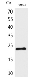 Fig.1. Western Blot analysis of HepG2 cells using SNAP 23 Polyclonal Antibody. Secondary antibody (catalog#: A21020) was diluted at 1:20000.
