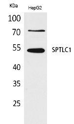 Fig.1. Western Blot analysis of HepG2 cells using SPTLC1 Polyclonal Antibody. Antibody was diluted at 1:500. Secondary antibody (catalog#: A21020) was diluted at 1:20000.