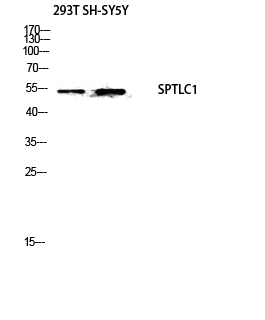 Fig.2. Western blot analysis of 293T SH-SY5Y lysis using SPTLC1 antibody. Antibody was diluted at 1:500. Secondary antibody (catalog#: A21020) was diluted at 1:20000.