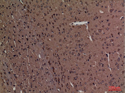 Fig.3. Immunohistochemical analysis of paraffin-embedded rat-brain, antibody was diluted at 1:100.