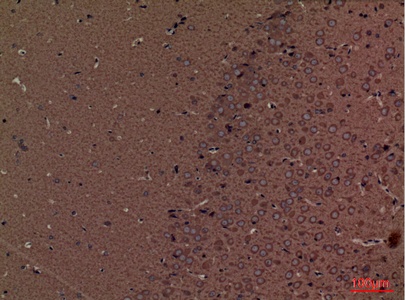 Fig.6. Immunohistochemical analysis of paraffin-embedded Mouse-brain, antibody was diluted at 1:100.