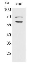 Fig.1. Western Blot analysis of HepG2 cells using HEXA Polyclonal Antibody. Antibody was diluted at 1:1000. Secondary antibody (catalog#: A21020) was diluted at 1:20000.
