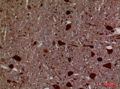 Fig.2. Immunohistochemical analysis of paraffin-embedded rat-brain, antibody was diluted at 1:100.