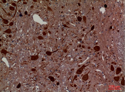 Fig.3. Immunohistochemical analysis of paraffin-embedded rat-brain, antibody was diluted at 1:100.