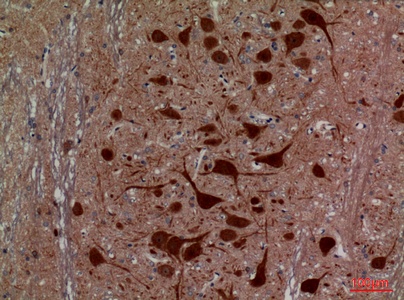 Fig.4. Immunohistochemical analysis of paraffin-embedded rat-brain, antibody was diluted at 1:100.
