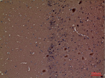 Fig.5. Immunohistochemical analysis of paraffin-embedded Mouse-brain, antibody was diluted at 1:100.
