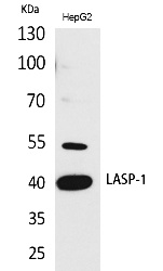 Fig. Western Blot analysis of HepG2 cells using LASP-1 Polyclonal Antibody. Antibody was diluted at 1:500. Secondary antibody (catalog#: A21020) was diluted at 1:20000.