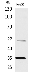 Fig. Western Blot analysis of HepG2 cells using TFPI Polyclonal Antibody. Secondary antibody (catalog#: A21020) was diluted at 1:20000.