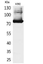 Fig.1. Western Blot analysis of K562 cells using Transferrin Polyclonal Antibody. Antibody was diluted at 1:500. Secondary antibody (catalog#: A21020) was diluted at 1:20000.