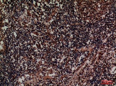Fig.3. Immunohistochemical analysis of paraffin-embedded human-lymph, antibody was diluted at 1:100.