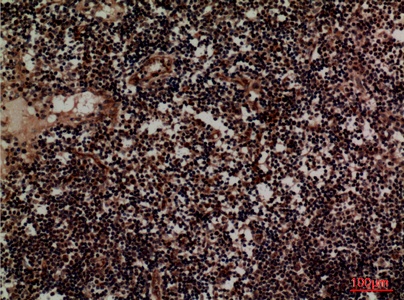 Fig.4. Immunohistochemical analysis of paraffin-embedded human-lymph, antibody was diluted at 1:100.
