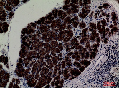 Fig.3. Immunohistochemical analysis of paraffin-embedded human-pancreas, antibody was diluted at 1:100.
