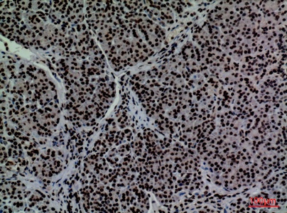 Fig.3. Immunohistochemical analysis of paraffin-embedded human-pancreas, antibody was diluted at 1:100.
