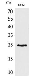Fig.1. Western Blot analysis of K562 cells using CD7 Polyclonal Antibody. Secondary antibody (catalog#: A21020) was diluted at 1:20000.