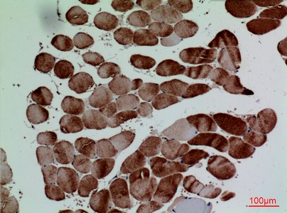 Fig.2. Immunohistochemical analysis of paraffin-embedded human-muscle, antibody was diluted at 1:100.