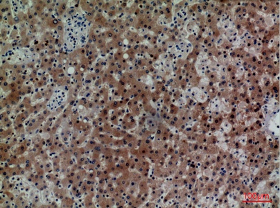 Fig.3. Immunohistochemical analysis of paraffin-embedded human-liver, antibody was diluted at 1:100.