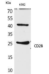 Fig. Western Blot analysis of K562 cells using CD28 Polyclonal Antibody. Secondary antibody (catalog#: A21020) was diluted at 1:20000.