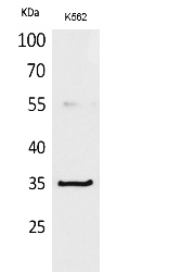 Fig. Western Blot analysis of K562 cells using CD32-A Polyclonal Antibody. Secondary antibody (catalog#: A21020) was diluted at 1:20000.