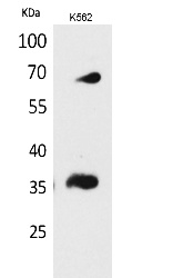 Fig. Western Blot analysis of K562 cells using CD32-B/C Polyclonal Antibody. Secondary antibody (catalog#: A21020) was diluted at 1:20000.