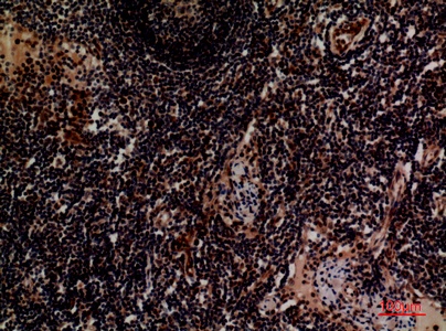 Fig.3. Immunohistochemical analysis of paraffin-embedded human-lymph, antibody was diluted at 1:100.