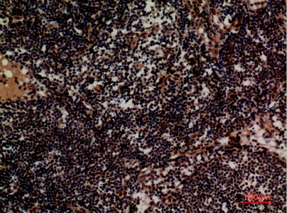 Fig.4. Immunohistochemical analysis of paraffin-embedded human-lymph, antibody was diluted at 1:100.