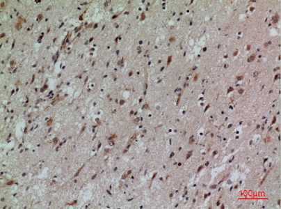 Fig.2. Immunohistochemical analysis of paraffin-embedded human-brain, antibody was diluted at 1:100.