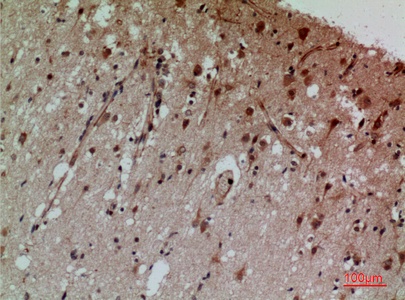 Fig.3. Immunohistochemical analysis of paraffin-embedded human-brain, antibody was diluted at 1:100.
