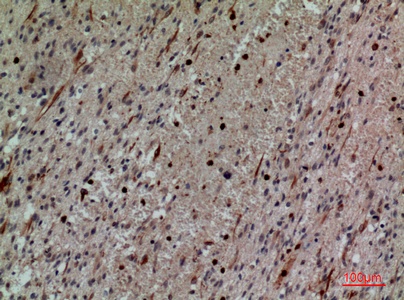 Fig.4. Immunohistochemical analysis of paraffin-embedded human-brain, antibody was diluted at 1:100.