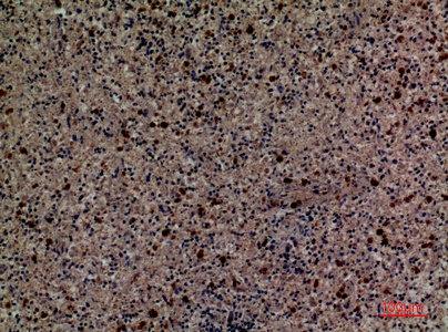 Fig.5. Immunohistochemical analysis of paraffin-embedded human-spleen, antibody was diluted at 1:100.