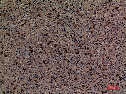 Fig.6. Immunohistochemical analysis of paraffin-embedded human-spleen, antibody was diluted at 1:100.