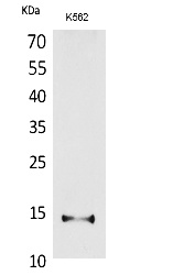 Fig.1. Western Blot analysis of K562 cells using CD59 Polyclonal Antibody. Secondary antibody (catalog#: A21020) was diluted at 1:20000.